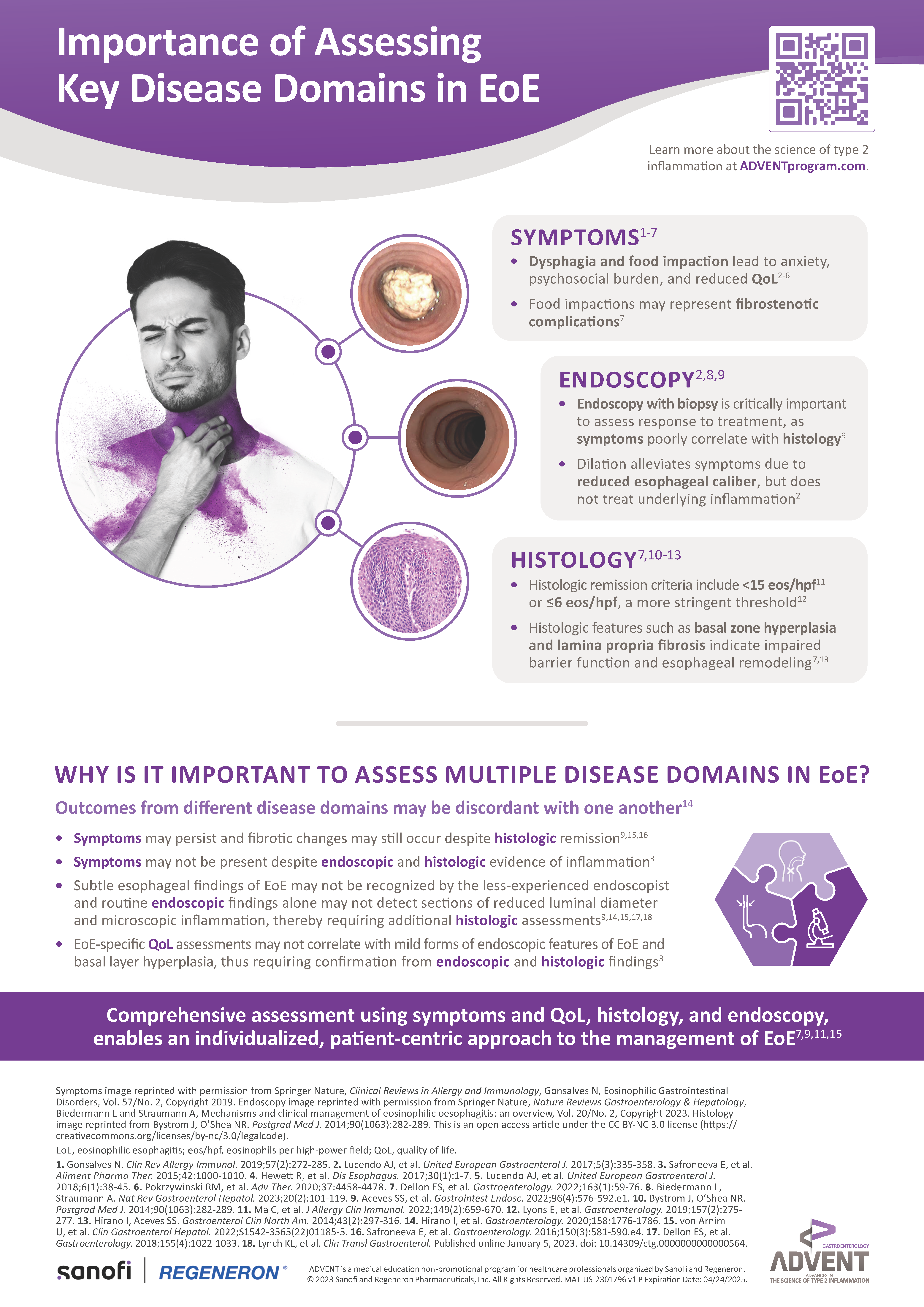 Importance of Assessing Key Disease Domains in EoE Infographic